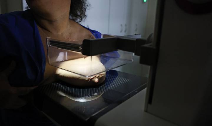 ANS defende que plano cubra mamografia digital sem restrição de idade