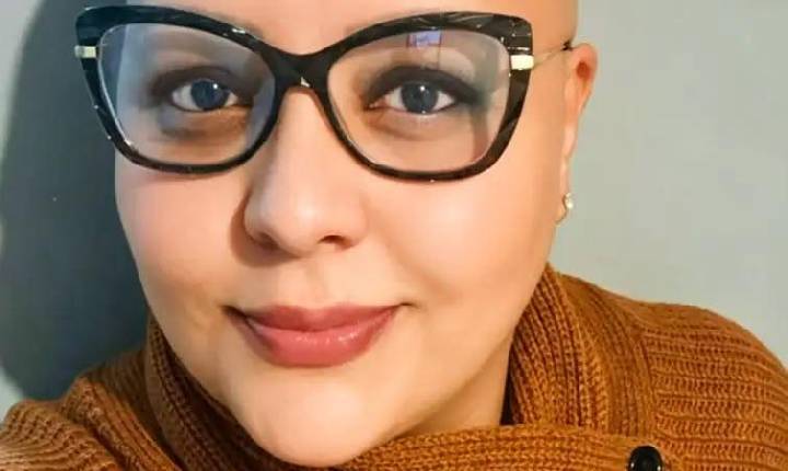 Queda de cabelo pode sinalizar diferentes tipos de alopecia e exige diagnóstico correto