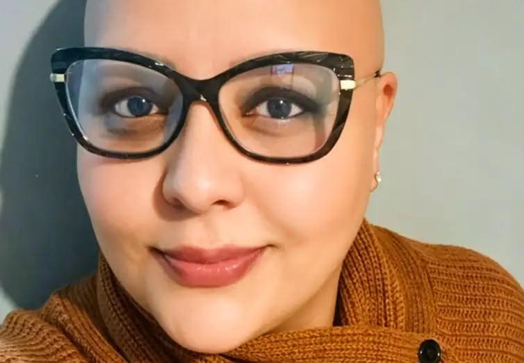 Queda de cabelo pode sinalizar diferentes tipos de alopecia e exige diagnóstico correto